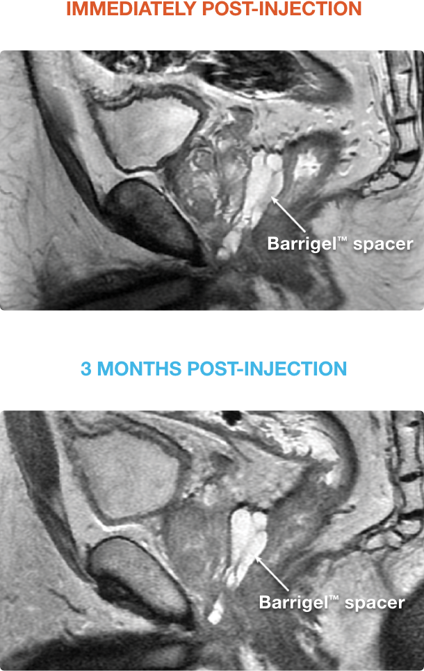hcp-clinical-studies--seperation-m1-2-1