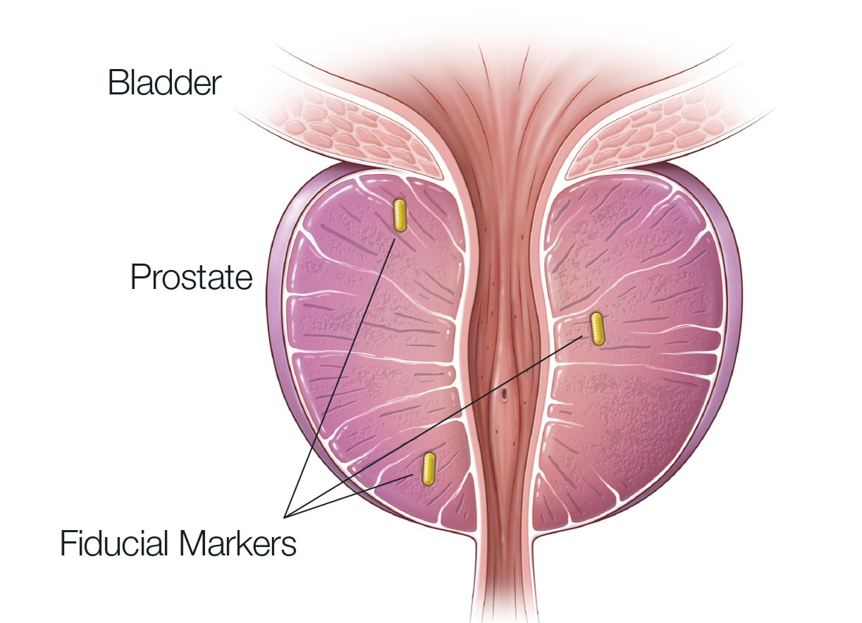Fiducial Marker diagram edu deck